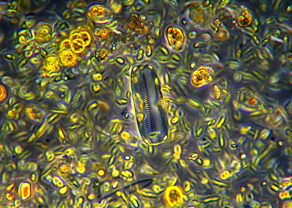 Pinnularia